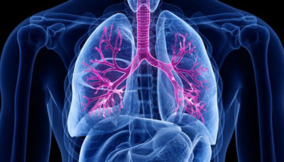 什么是慢性阻塞性肺病 (Chronic Obstructive Pulmonary Disease)，為何與新冠疫情有關(guān)？